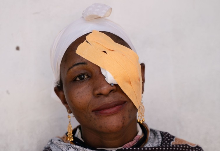 Fighting trachoma: Empowering communities for sustainable health solutions