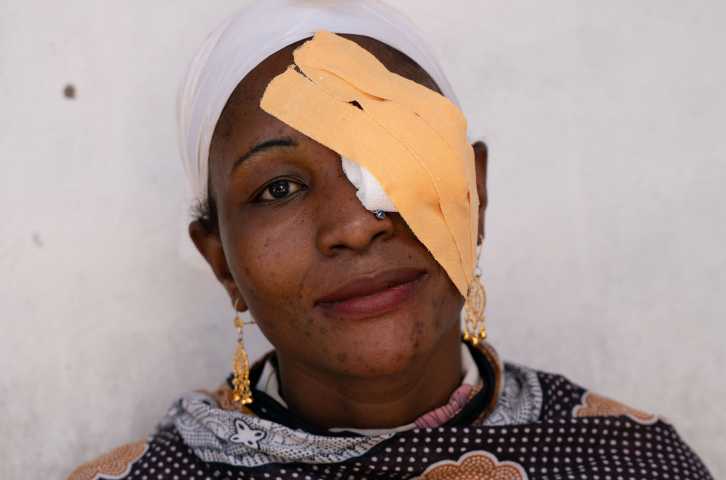 Woman sits in front of a white wall with a yellow eye patch following trachoma surgery at a clinic in Tanzania
