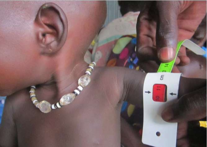 OFDA nutrition South Sudan – Mary OFDA nutrition South Sudan