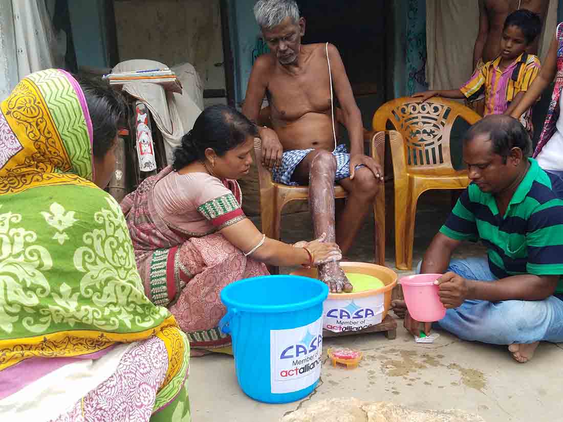 IMA and CASA reach thousands suffering from lymphatic filariasis in India