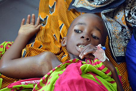 Asha was diagnosed with Burkitt's Lymphoma at Muhimbili National Hospital in Tanzania. (Josephat Mugunda/IMA World Health)
